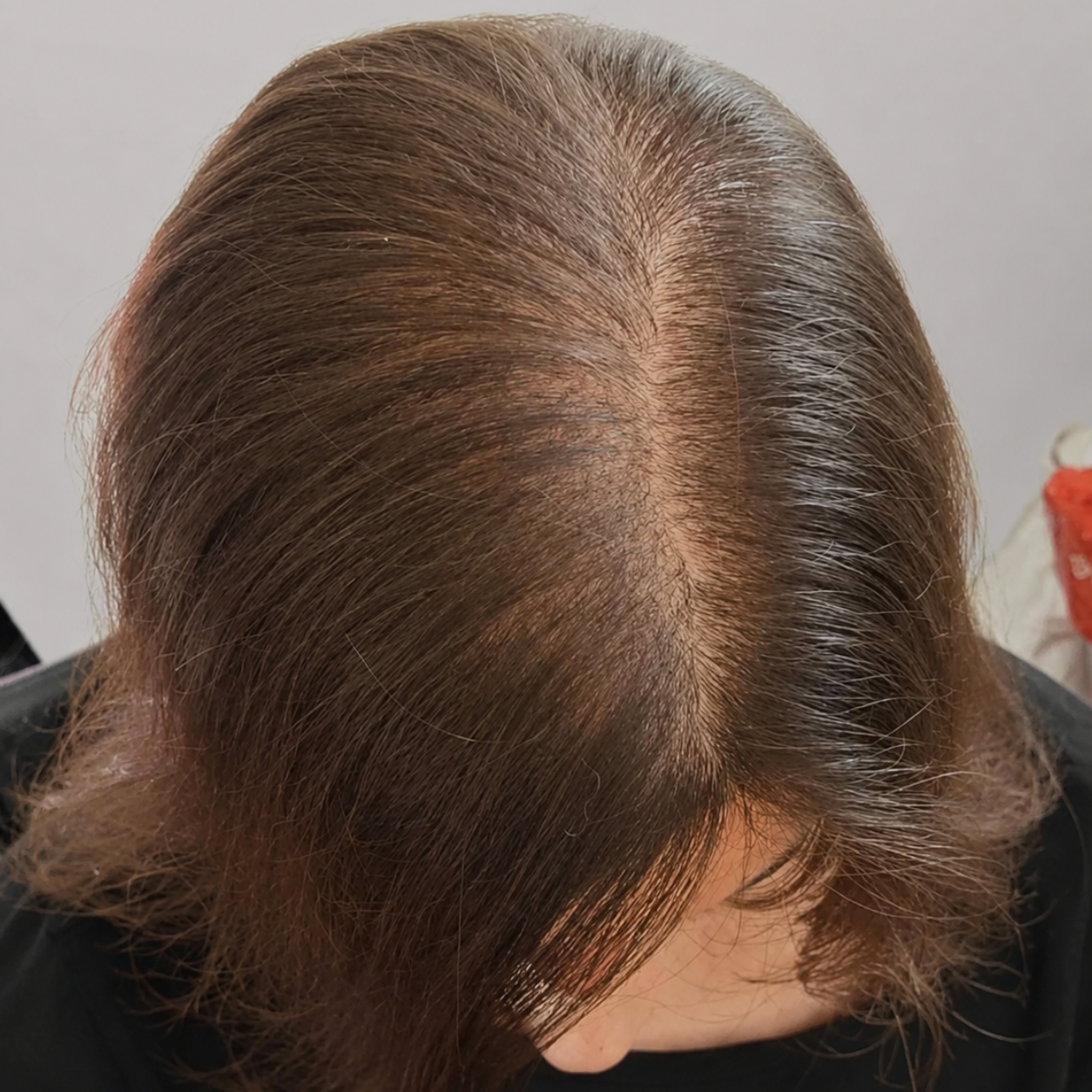 Hair and scalp after approximately two months of use